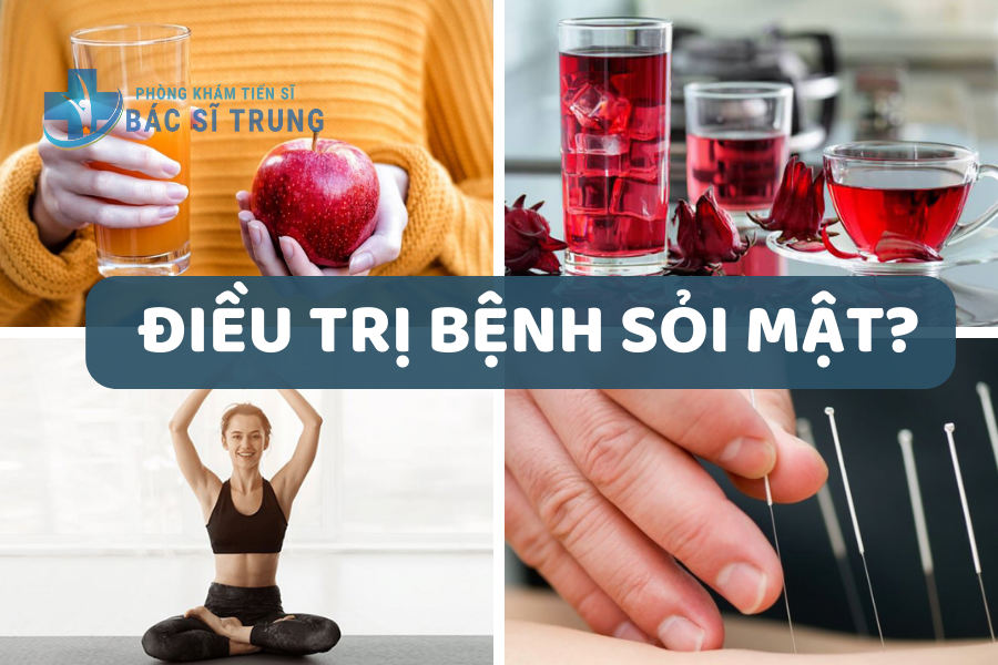 Điều trị bệnh sỏi mật
