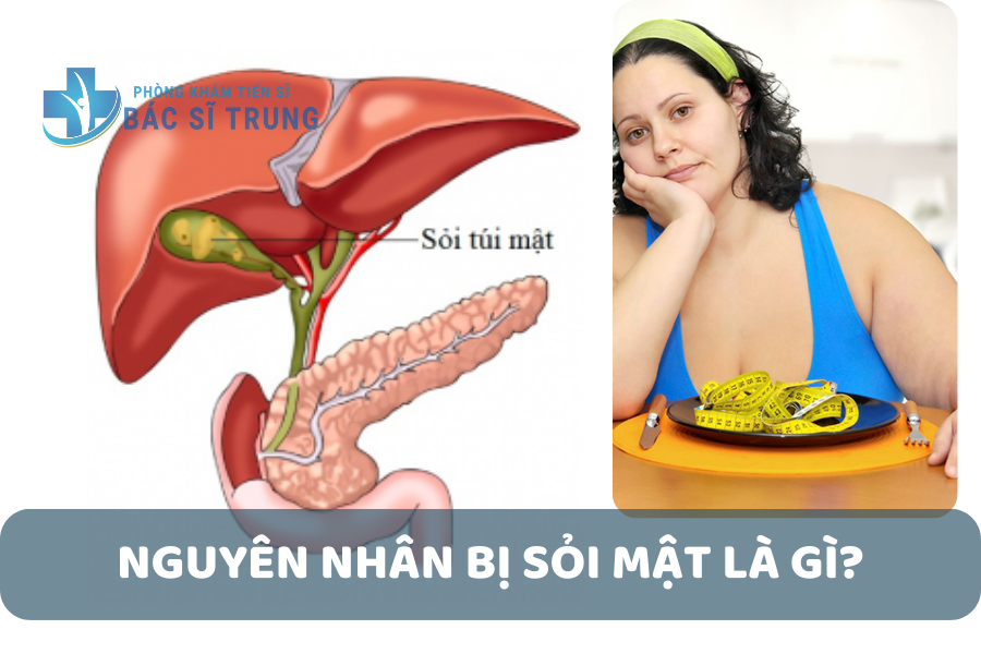 Nguyên nhân bị bệnh sỏi mật