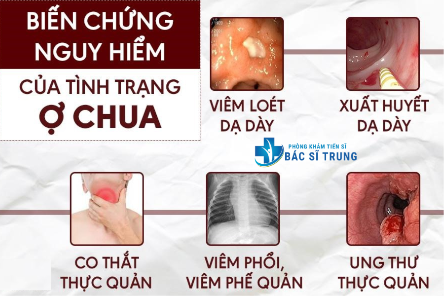 ợ chua sau khi ăn