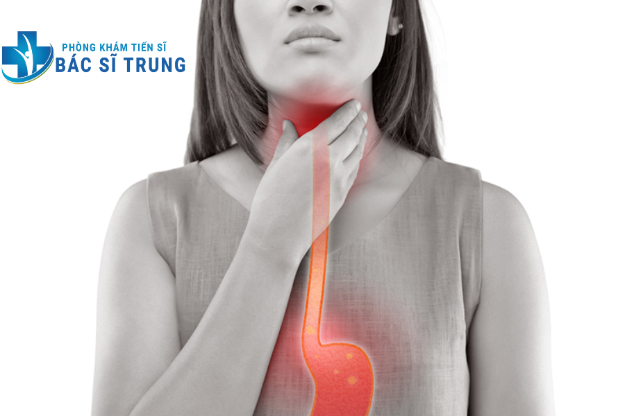 ợ chua sau khi ăn