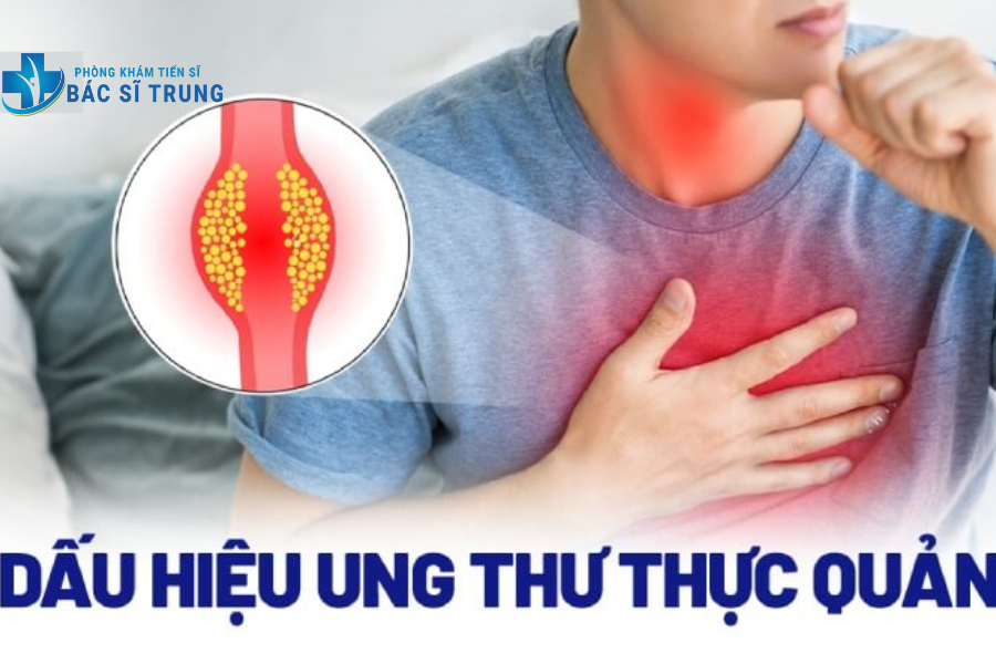 dấu hiệu ung thư thực quản