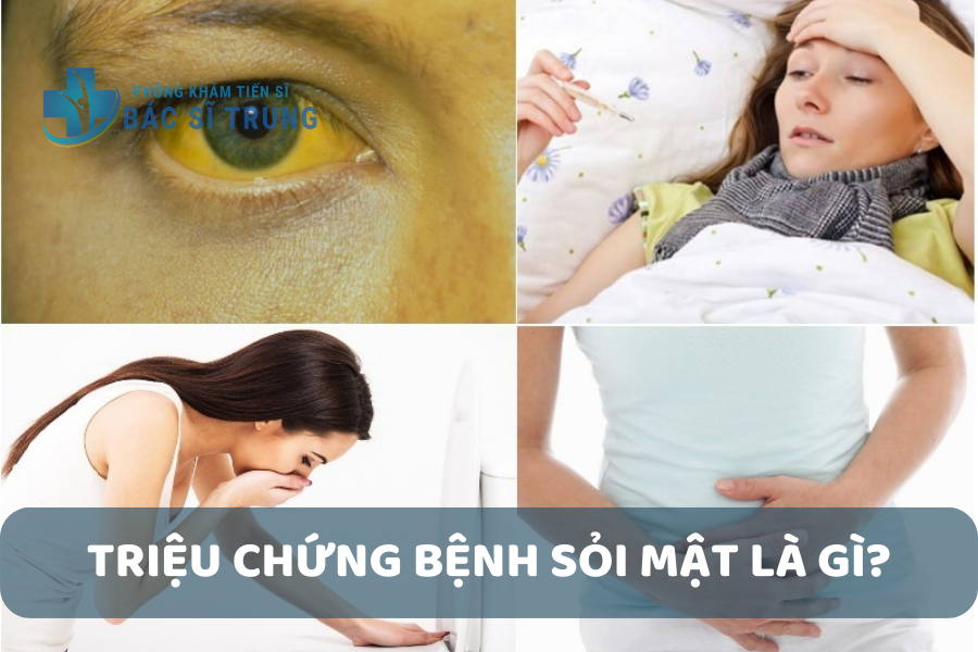Triệu chứng bệnh sỏi mật.