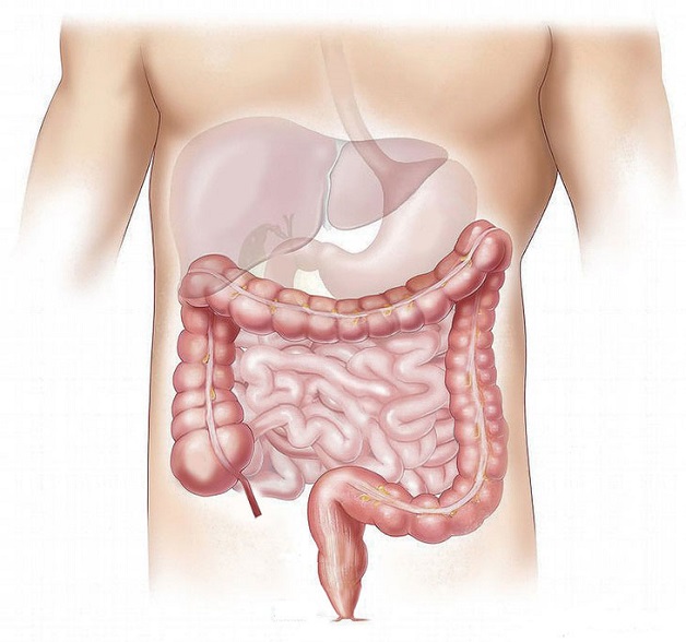 Bệnh lý ruột non