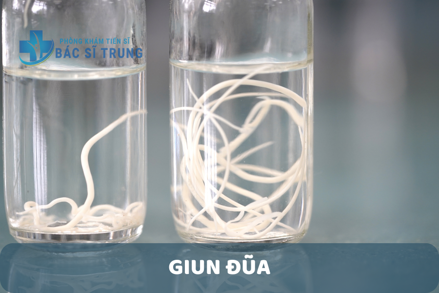 Giun đũa