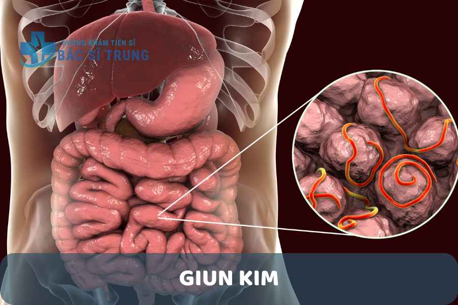Giun kim