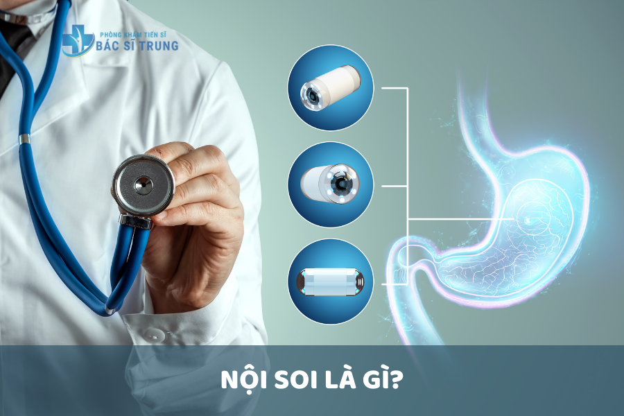 Nội soi là gì?