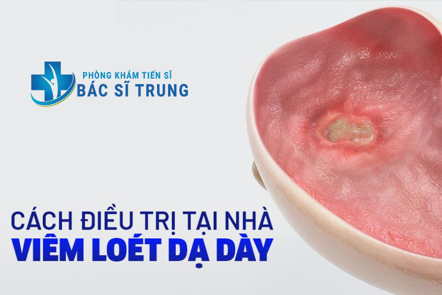 điều trị viêm loét dạ dày