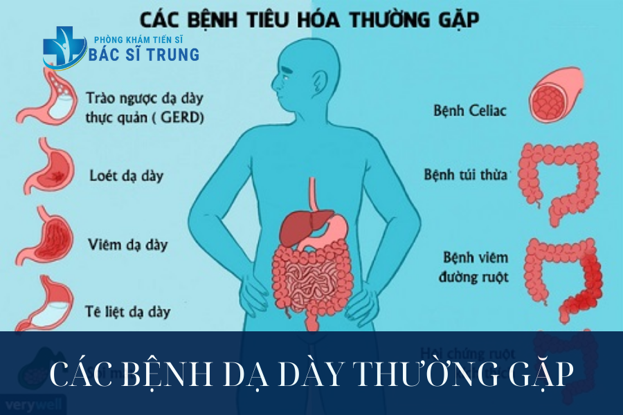 Các bệnh dạ dày thường gặp